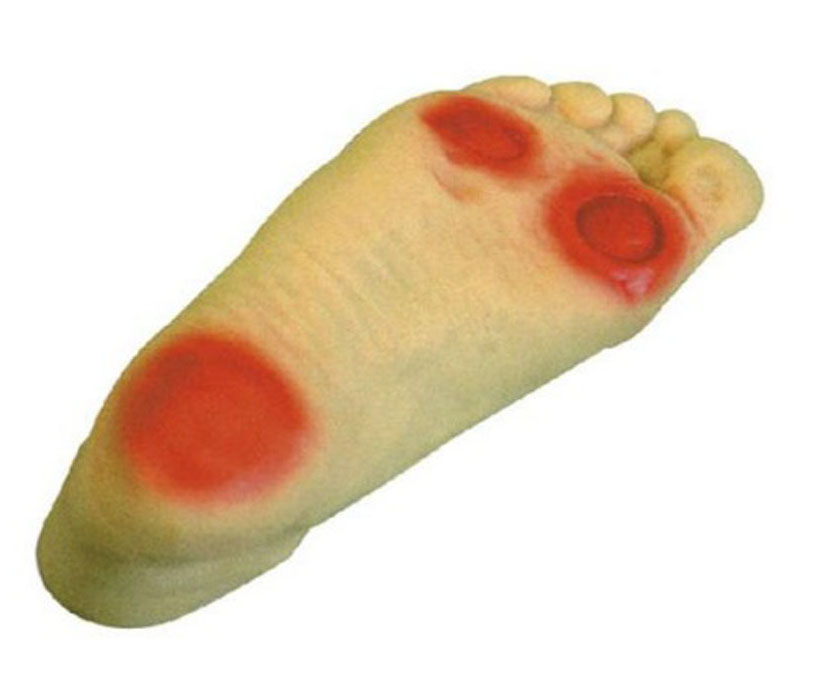 高级糖尿病足护理模型