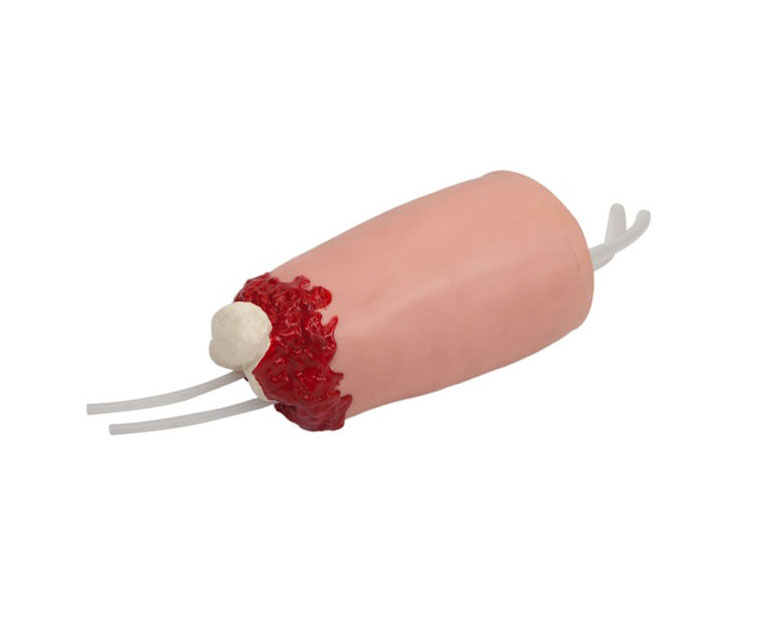 下肢外伤断肢止血模型