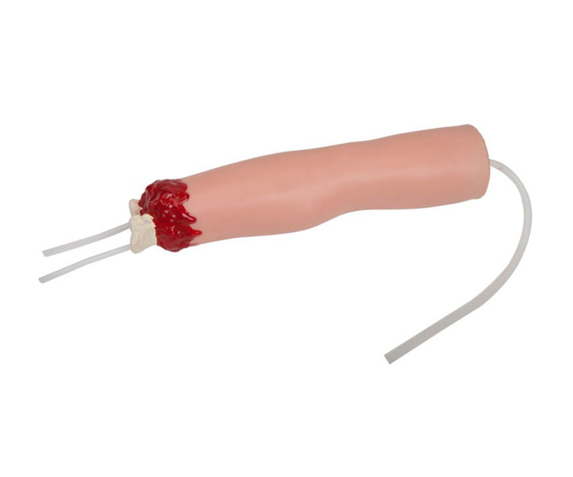 上肢外伤断肢止血模型