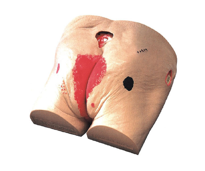 高级褥疮护理模型