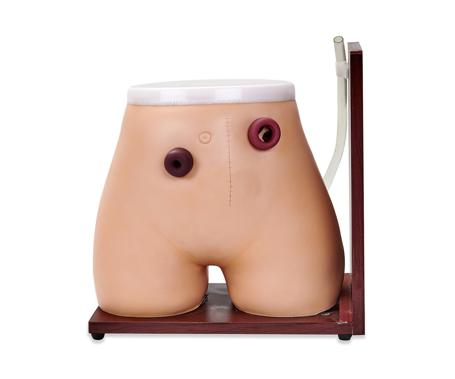 高级瘘管造口术护理模型