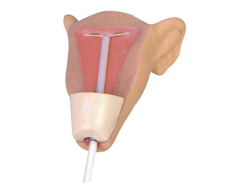 高级宫内避孕器训练模型