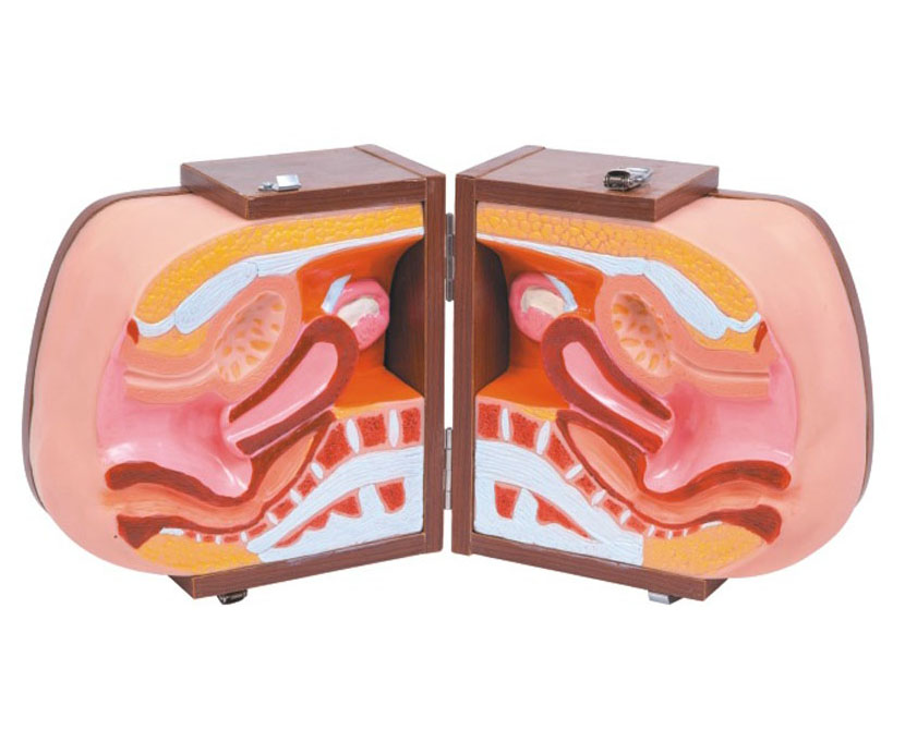 高级女性避孕器指导模型