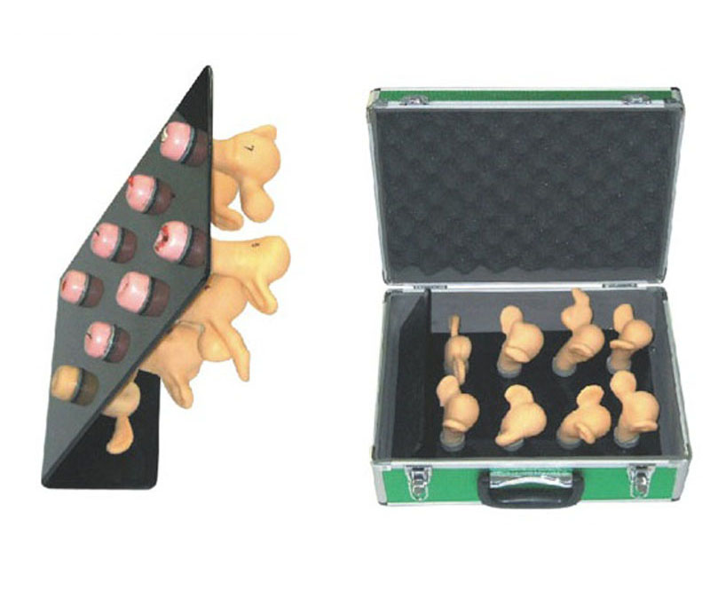 高级子宫宫颈病变模型（8件）