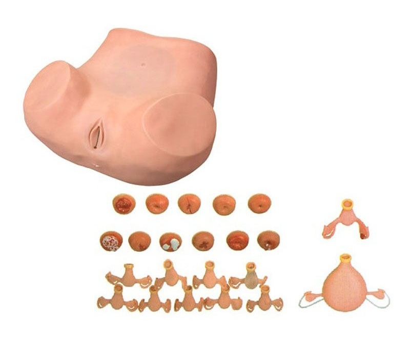 高级妇科检查模型