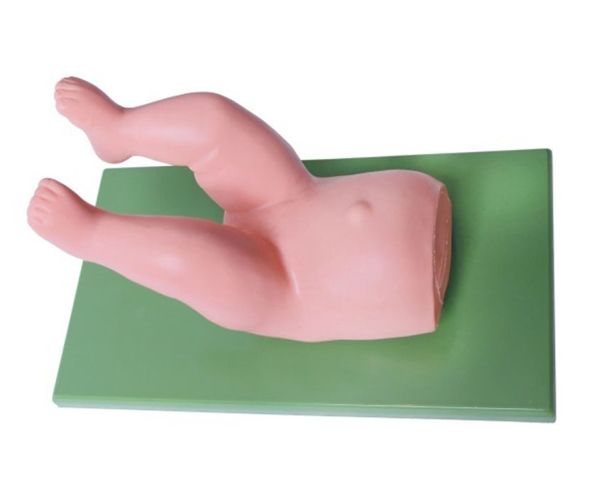 婴儿髋关节复位操作模型