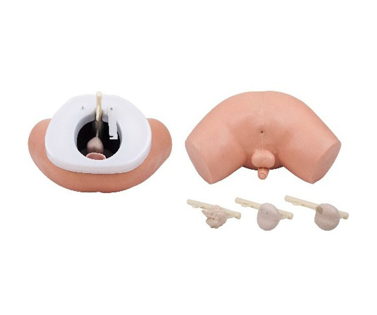 前列腺检查模型